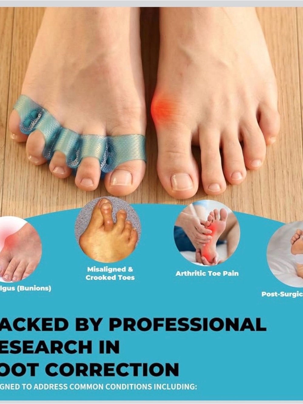 Toe Separators - Picture 7 of 10